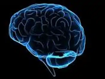 Brain Image
